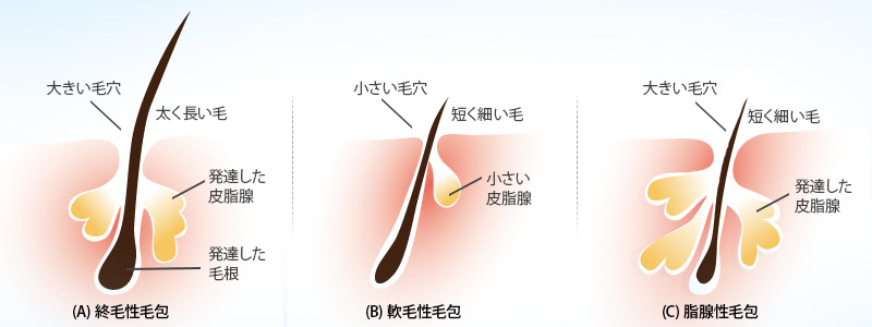 (A) 終毛性毛包:大きい毛穴、太く長い毛、発達した皮脂腺、発達した毛根。(B) 軟毛性毛包：小さい毛穴、短く細い毛、小さい皮脂腺。(C) 脂腺性毛包：大きい毛穴、短く細い毛、発達した皮脂腺