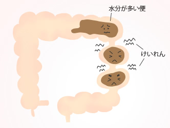 交互にやってくる便秘と下痢は 心と体のsos信号 摩耶堂製薬 ロート製薬グループ