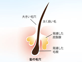 頭皮ニキビができる納得の原因と すぐできる対策３つ 摩耶堂製薬 ロート製薬グループ