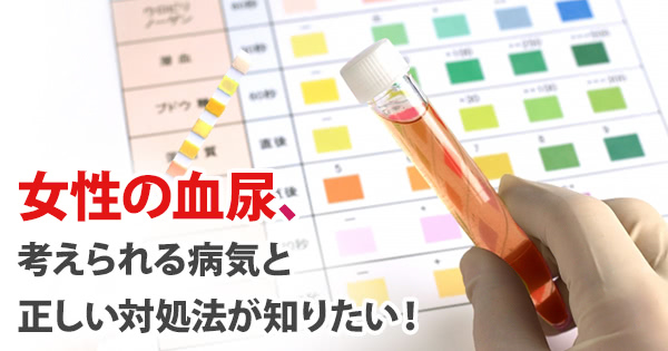 女性の血尿 考えられる病気と正しい対処法が知りたい 摩耶堂製薬 ロート製薬グループ
