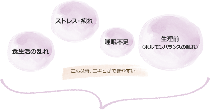 【・食生活の乱れ】【・ストレス・疲れ】【・睡眠不足】【・生理前（ホルモンバランスの乱れ）】こんな時、ニキビができやすい